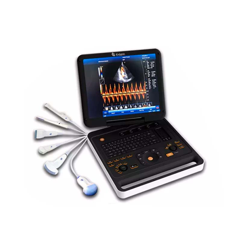 Doppler Color YR05150: Innovación en Diagnóstico Ultrasónico