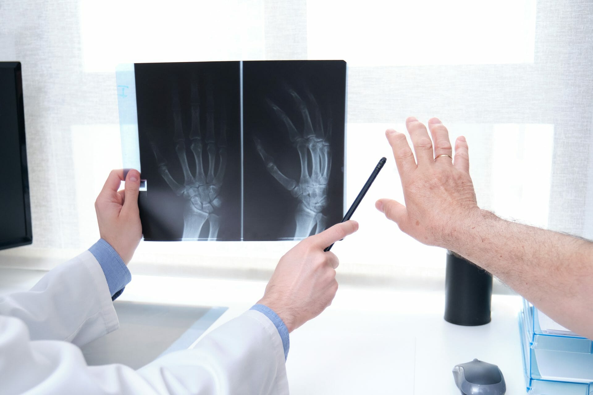 Artritis Gotosa: Eficacia y seguridad del tratamiento