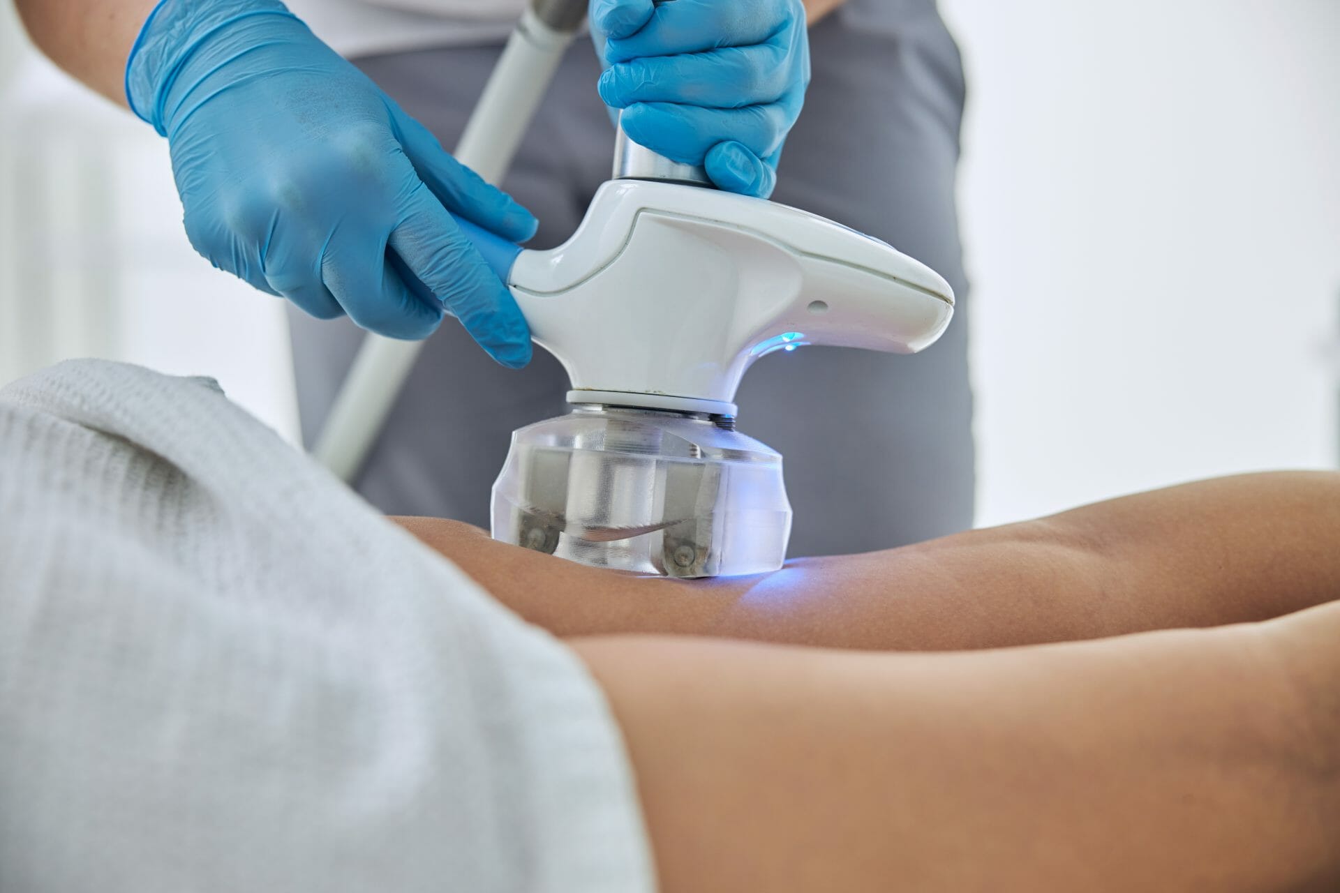 ¿Qué es el lipolaser?