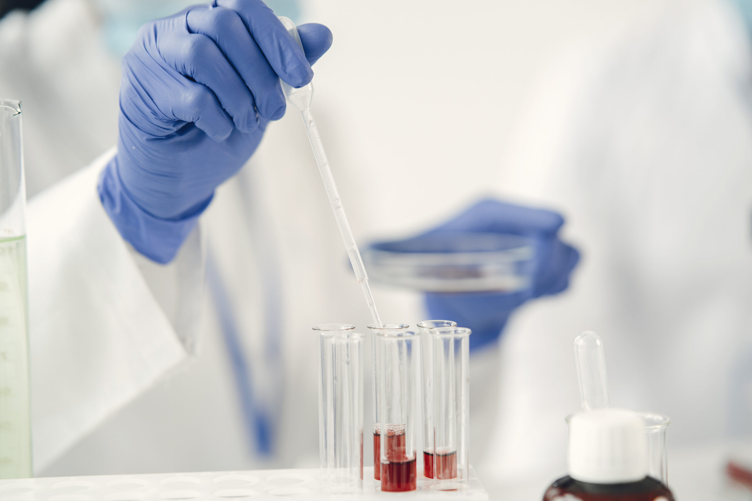 Un Test de Sangre Revolucionario para Detectar el Cáncer Antes de que Aparezcan los Síntomas